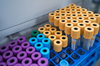 Blood collection tubes with colored caps arranged in blue laboratory racks