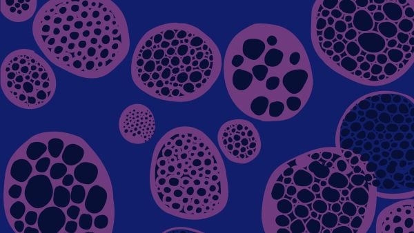 An abstract digital illustration representing sarcoidosis, featuring clusters of purple, irregular oval shapes containing smaller dark circles against a navy blue background, symbolizing granulomas.