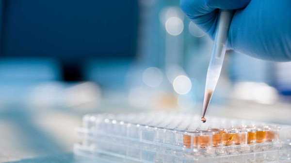 A gloved hand uses a pipette to dispense a liquid droplet into a clear 96-well microplate containing orange-colored samples in a laboratory setting..