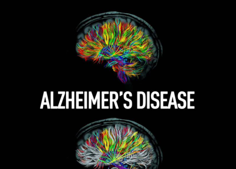  Alzheimer's Disease: A Giving Smarter Guide to Accelerate Development of New Therapies