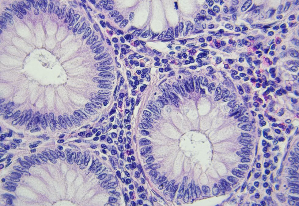 An abstract image of what appears to be purple and white cells under a microscope, they appear as white and purple blobs surrounded by speckles of shades of purple.