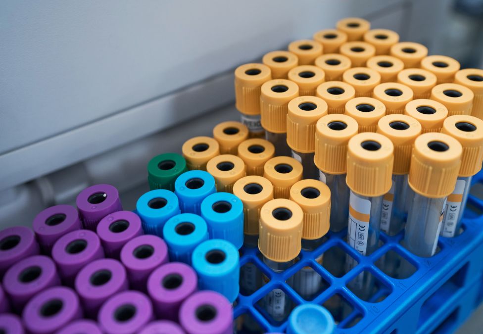 Blood collection tubes with colored caps arranged in blue laboratory racks